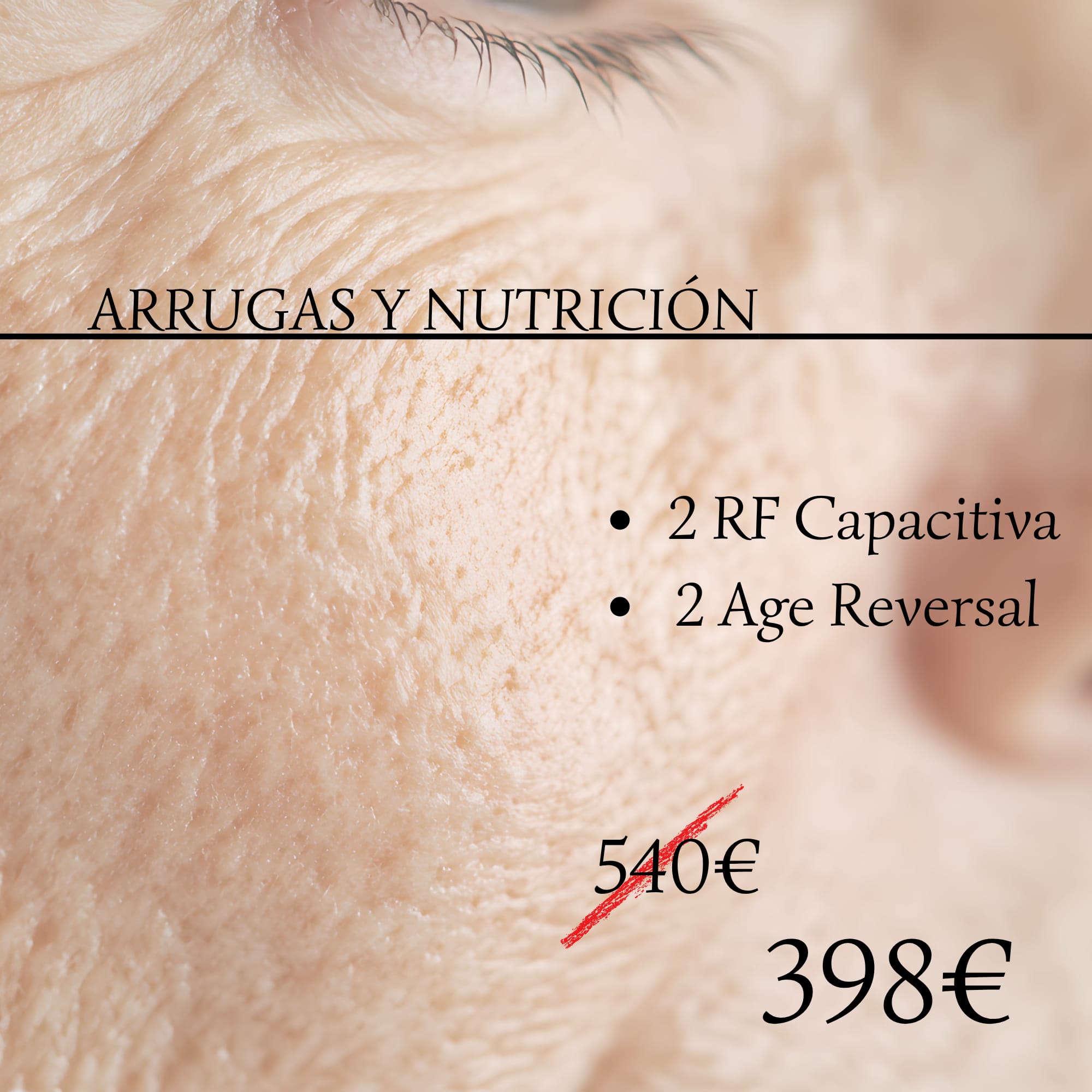 Arrugas y Nutrición facial (Oviedo y Gijón)