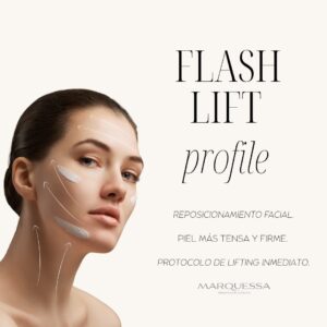 Flash Lift Profile
