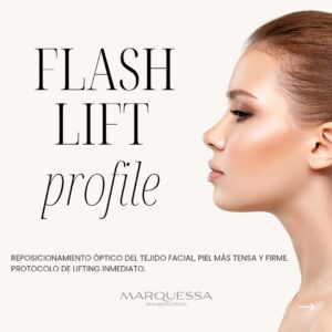Flash Lift Profile